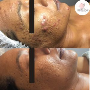 Facial2